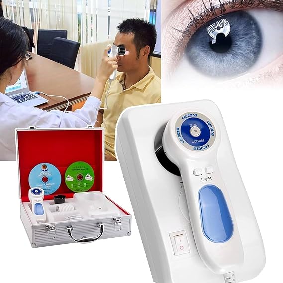 Iris Camera,USB Iriscope Iris Analyzer,Iris Eye Detector,Iris Eye Detector,Iris Lens Adjustable Focus and Driver-Free Analysis Software,for Beauty Salon, SPA